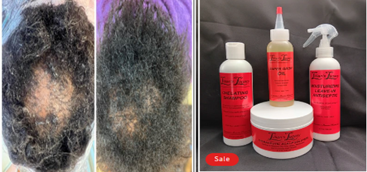 HAIR REGROWTH PACKAGE